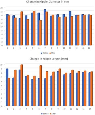 Lactation physiokinetics—using advances in technology for a fresh perspective on human milk transfer